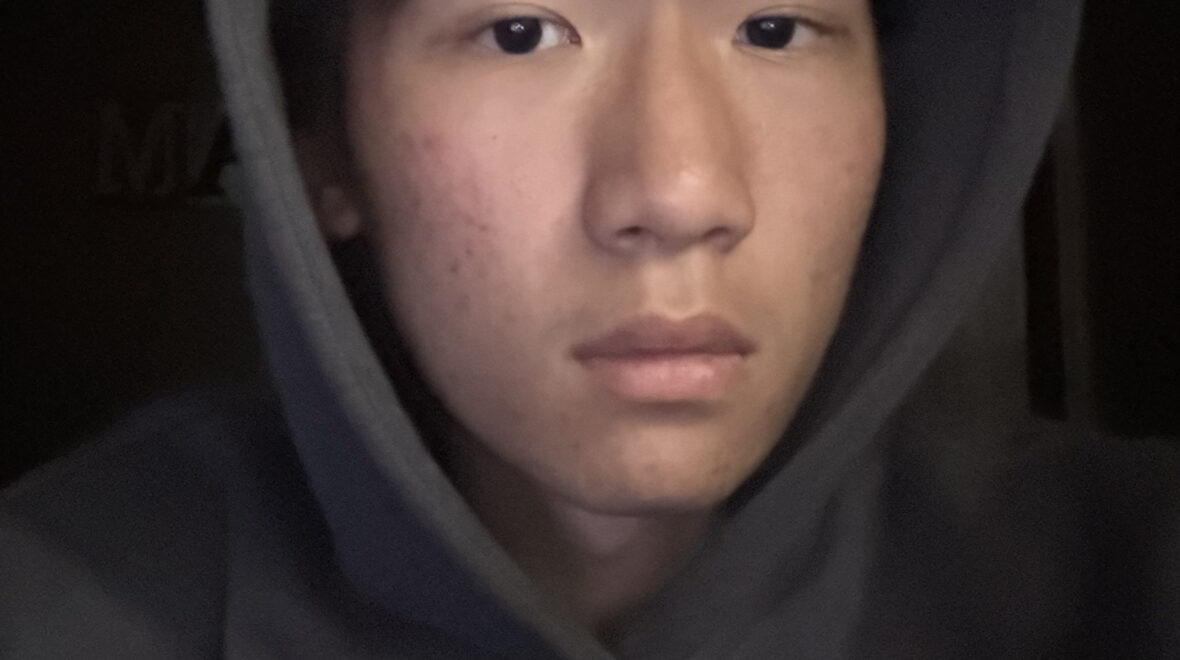 Facing a Colorless Life and Finding Positive Energy